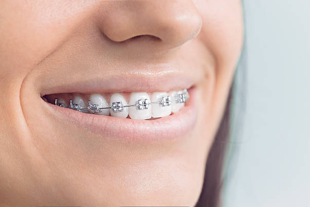 Why Choose Us for Your Dental Needs in La Mirada, CA